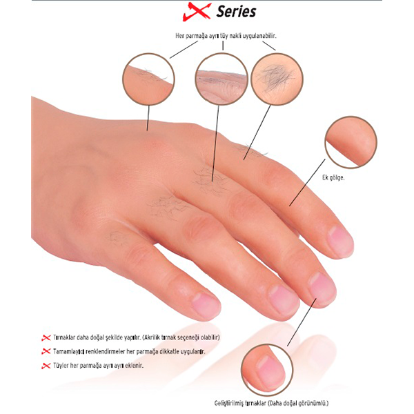 Cosmetic Silicone Hands & Advanced Mechanical Arm Solutions